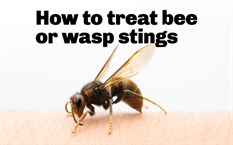 How To Treat Wasp Stings